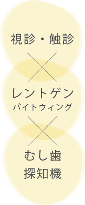 むし歯治療