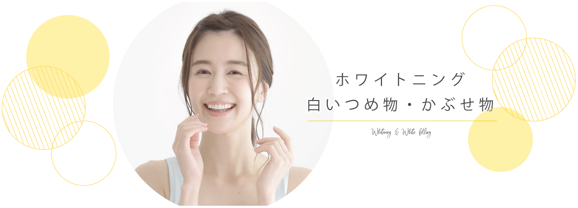 ホワイトニング・白いつめ物・かぶせ物